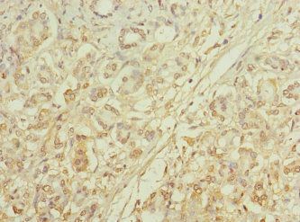 MRC2 Antibody
