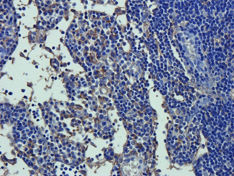 MRP2 Rabbit Polyclonal Antibody