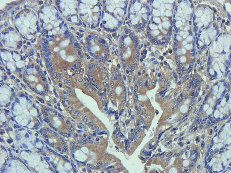 MRP2 Rabbit Polyclonal Antibody