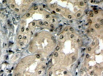 MRP5 Antibody
