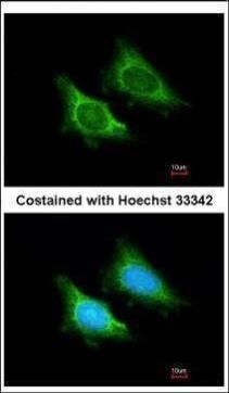 MRPS5 Rabbit Polyclonal Antibody