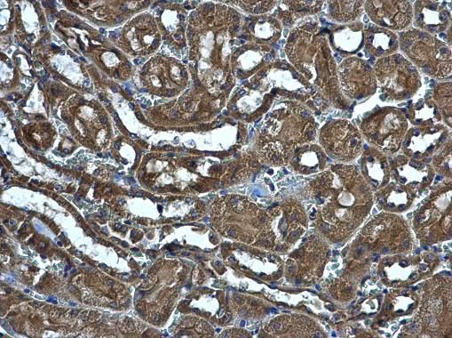 MRPS5 Rabbit Polyclonal Antibody