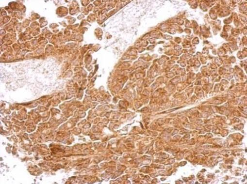 MRPS5 Rabbit Polyclonal Antibody