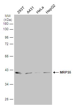 MRPS5 Rabbit Polyclonal Antibody