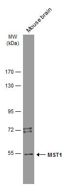 MST1 Rabbit Polyclonal Antibody