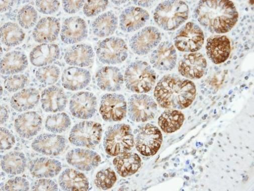 MST4 Rabbit Polyclonal Antibody