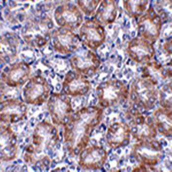 MTCH2 Rabbit Polyclonal Antibody