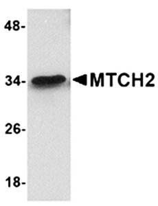 MTCH2 Rabbit Polyclonal Antibody