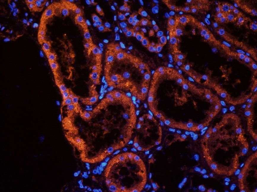 MUC1 Rabbit Polyclonal Antibody
