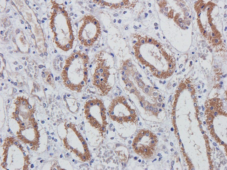 MUC1 Rabbit Polyclonal Antibody