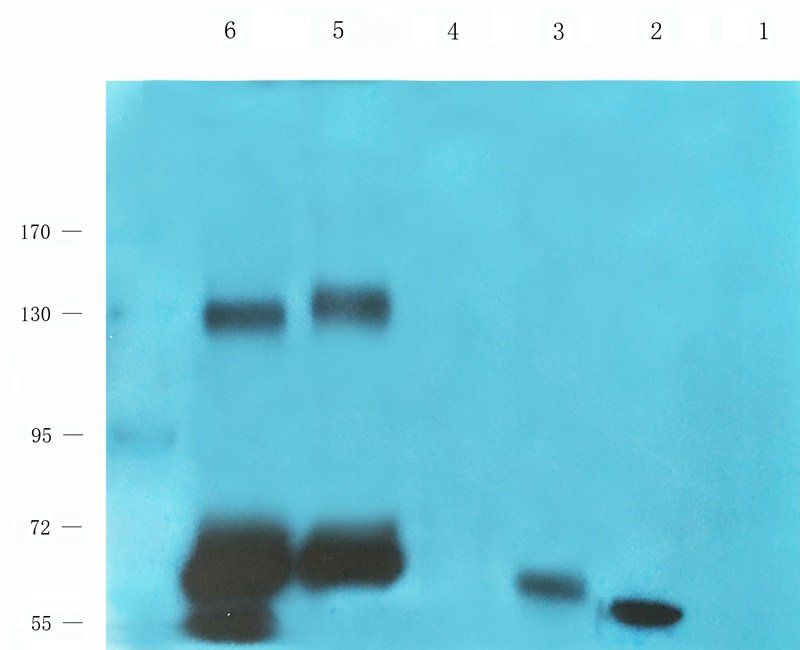 MUC1 Rabbit Polyclonal Antibody