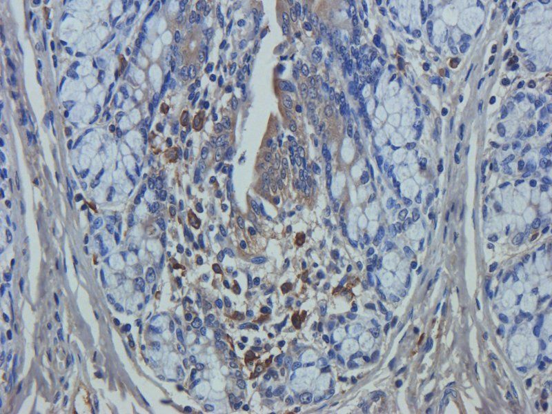 Mucin 5AC Rabbit Polyclonal Antibody