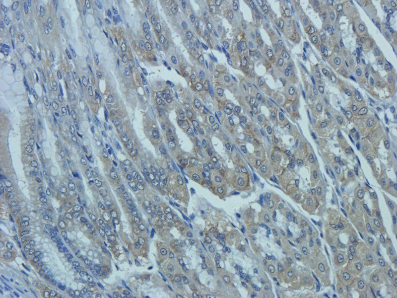 Mucin 5AC Rabbit Polyclonal Antibody