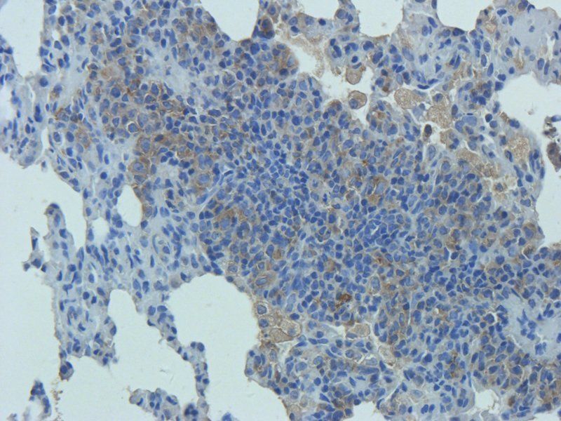 Mucin 5AC Rabbit Polyclonal Antibody