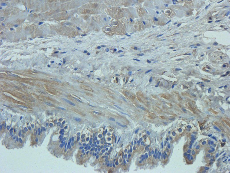 Mucin 5AC Rabbit Polyclonal Antibody