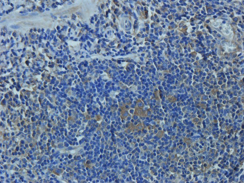 Mucin 5AC Rabbit Polyclonal Antibody