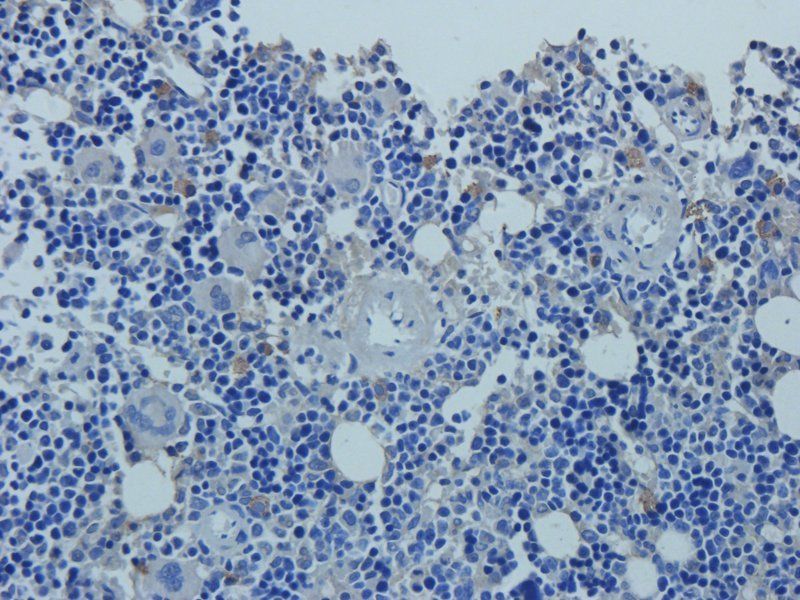 Mucin 5AC Rabbit Polyclonal Antibody