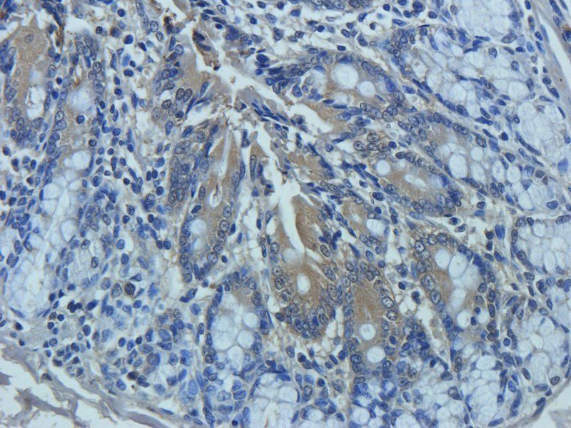 Mucin 5AC Rabbit Polyclonal Antibody