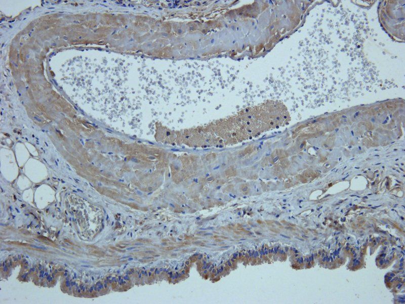 Mucin 5AC Rabbit Polyclonal Antibody
