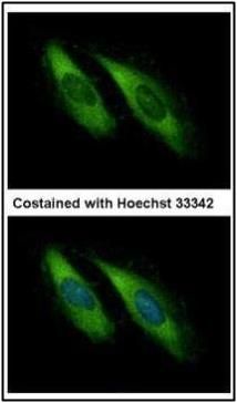 Munc 13-4 Rabbit Polyclonal Antibody