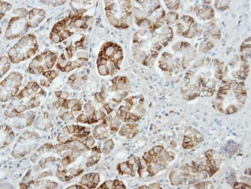 Munc 13-4 Rabbit Polyclonal Antibody