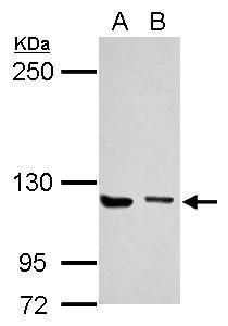 Munc 13-4 Rabbit Polyclonal Antibody