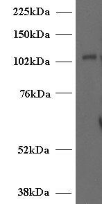 Munc13-4/UNC13D (Internal) Antibody