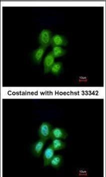 MVP/LRP Rabbit Polyclonal Antibody