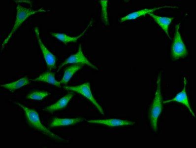 MX2 Antibody