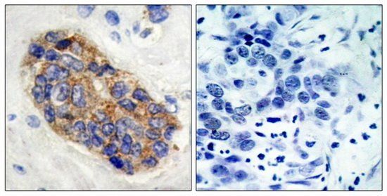 Myc (Phospho-Ser373) Antibody
