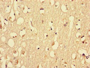 MYH3 Antibody