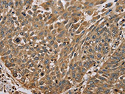 MYL3 Antibody