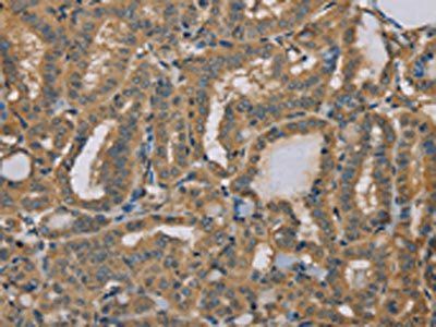 MYL3 Antibody