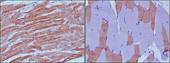 MYL3 Antibody