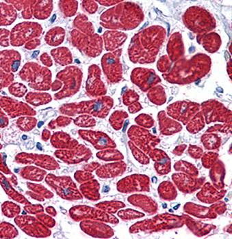 MYL3 Antibody