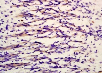 Phospho-MYL9 (Thr19) Rabbit Polyclonal Antibody