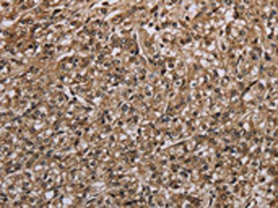 MYO18B Antibody