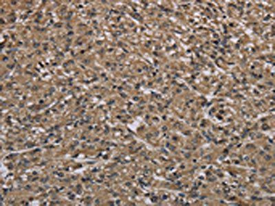 MYO18B Antibody