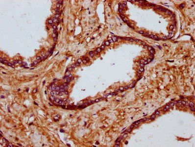 MYO1E Antibody