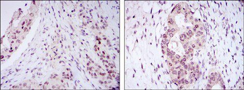 NACC1 Antibody
