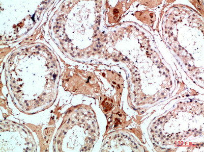 NANOS1 Antibody
