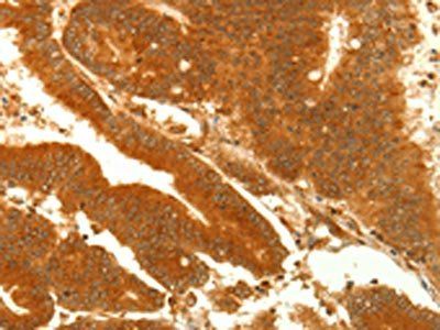 NAPA Antibody