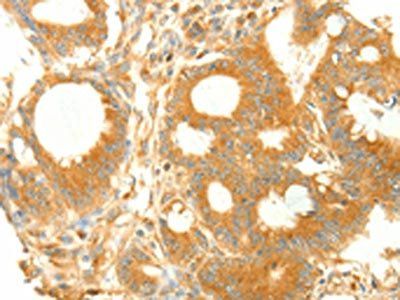 NAPA Antibody