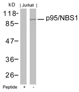NBN Antibody