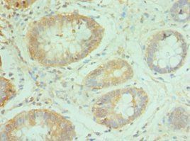 NCBP2 Antibody