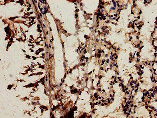 NCF2 Antibody