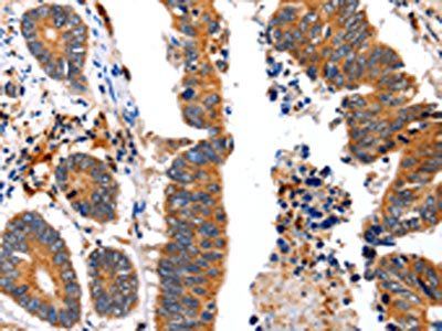 NCK1 Antibody