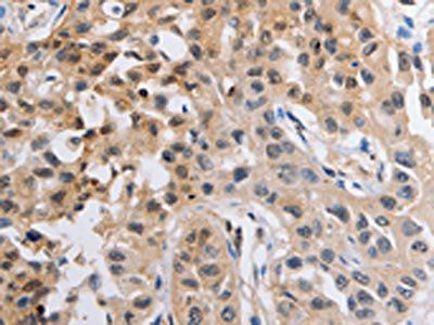 NCK1 Antibody