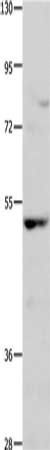 NCK1 Antibody