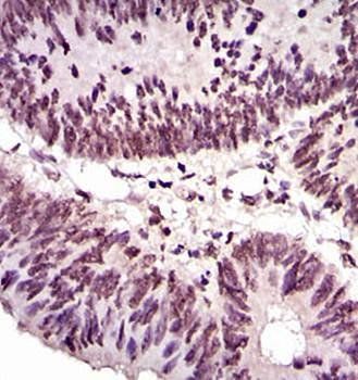 NCK1 Antibody